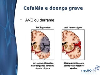 Cefaléia e doença grave
• AVC ou derrame

 
