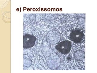 e) Peroxissomos
 