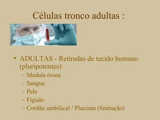 Células tronco adultas :
• ADULTAS - Retiradas de tecido humano
(pluripotentes)
– Medula óssea
– Sangue
– Pele
– Fígado
– Cordão umbilical / Placenta (limitação)
 