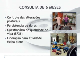 CONSULTA DE 6 MESES
 Controle das alterações
posturais
 Persistencia de dores
 Questionário de qualidade de
vida (SF36)
 Liberação para atividade
fícica plena
 