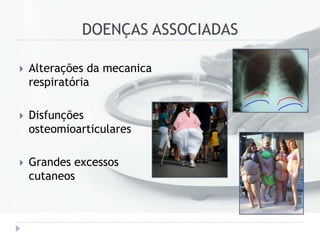 DOENÇAS ASSOCIADAS
 Alterações da mecanica
respiratória
 Disfunções
osteomioarticulares
 Grandes excessos
cutaneos
 