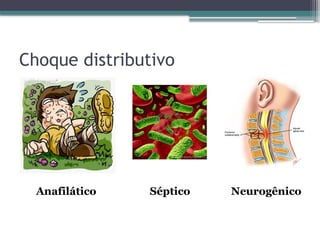 Choque distributivo
Anafilático Séptico Neurogênico
 
