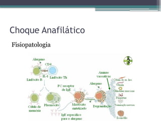 Choque Anafilático
Fisiopatologia
 