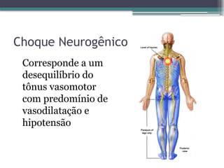 Choque Neurogênico
Corresponde a um
desequilíbrio do
tônus vasomotor
com predomínio de
vasodilatação e
hipotensão
 