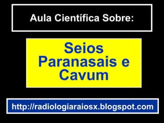 Aula Científica Sobre: Seios Paranasais e Cavum http://radiologiaraiosx.blogspot.com 