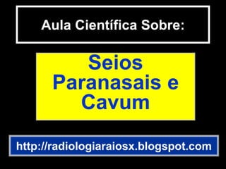 Aula Científica Sobre:
Seios
Paranasais e
Cavum
http://radiologiaraiosx.blogspot.com
 