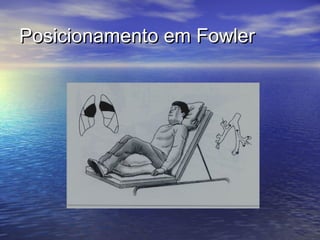 Posicionamento em Fowler
 