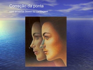 Correção da ponta
com enxertia óssea ou cartilagem
 