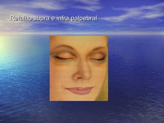 Retalho supra e infra palpebral
 