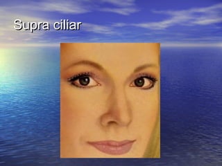 Supra ciliar
 