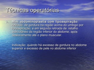 Técnicas operatórias
3.   Mini abdominoplastia com lipoaspiração:
     retirada de gordura na região acima do umbigo por
     lipoaspiração, e em seguida retirada de retalho
     subcutâneo da região inferior do abdome, após
     deslocamento até o plano muscular.


     Indicação: quando há excesso de gordura no abdome
     superior e excesso de pele no abdome inferior
 