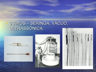 • 3 TIPOS – SERINGA, VÁCUO,
 ULTRASSÔNICA.
 