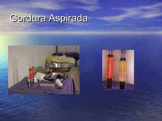 Gordura Aspirada
 