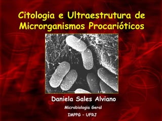 Citologia e Ultraestrutura de Microrganismos Procarióticos Daniela Sales Alviano Microbiologia Geral IMPPG – UFRJ 
