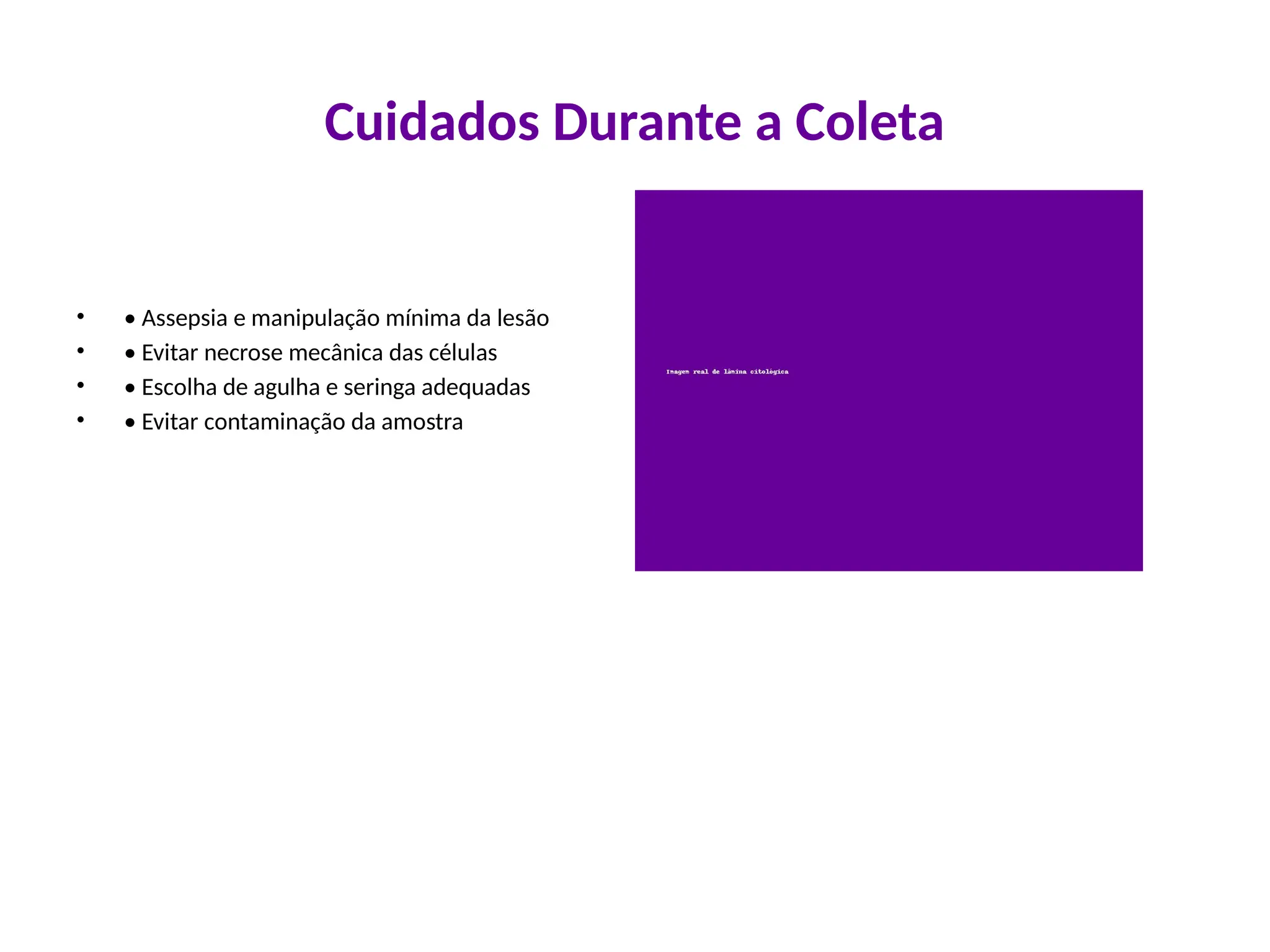 Cuidados Durante a Coleta
• • Assepsia e manipulação mínima da lesão
• • Evitar necrose mecânica das células
• • Escolha de agulha e seringa adequadas
• • Evitar contaminação da amostra
 
