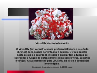 Vírus HIV atacando leucócito O vírus HIV (em vermelho) ataca preferencialmente o leucócito (branco) denominado por linfócito T auxiliar. O vírus penetra nesta célula e a destrói. O linfócito T auxiliar tem a função de coordenar a função de defesa imunológica contra vírus, bactérias e fungos. A sua destruição pelo vírus HIV dá início à deficiência imunológica.  Microscopia de varredura: aumento de 20.000 vezes.  