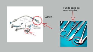 Lúmen
Fundo cego ou
reentrâncias
 