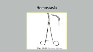 Hemostasia
 