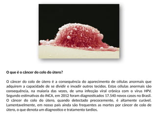 O que é o câncer do colo do útero?
O câncer do colo de útero é a consequência do aparecimento de células anormais que
adquirem a capacidade de se dividir e invadir outros tecidos. Estas células anormais são
consequência, na maioria das vezes, de uma infecção viral crônica com o virus HPV.
Segundo estimativas do INCA, em 2012 foram diagnosticados 17.540 novos casos no Brasil.
O câncer do colo do útero, quando detectado precocemente, é altamente curável.
Lamentavelmente, em nosso país ainda são frequentes as mortes por câncer de colo de
útero, o que denota um diagnostico e tratamento tardios.
 