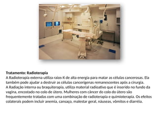Tratamento: Radioterapia
A Radioterapia externa utiliza raios-X de alta energia para matar as células cancerosas. Ela
também pode ajudar a destruir as células cancerígenas remanescentes após a cirurgia.
A Radiação interna ou braquiterapia, utiliza material radioativo que é inserido no fundo da
vagina, encostado no colo de útero. Mulheres com câncer do colo do útero são
frequentemente tratadas com uma combinação de radioterapia e quimioterapia. Os efeitos
colaterais podem incluir anemia, cansaço, malestar geral, náuseas, vômitos e diarréia.
 