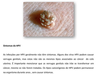 Sintomas do HPV
As infecções por HPV geralmente não têm sintomas. Alguns dos vírus HPV podem causar
verrugas genitais, mas estas não são os mesmos tipos associados ao câncer do colo
uterino. É importante mencionar que as verrugas genitais não irão se transformar em
câncer, mesmo se não forem tratadas. Os tipos cancerigenos de HPV podem permanecer
no organismo durante anos , sem causar sintomas.
 