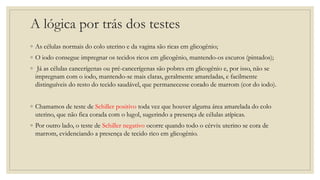 A lógica por trás dos testes
◦ As células normais do colo uterino e da vagina são ricas em glicogênio;
◦ O iodo consegue impregnar os tecidos ricos em glicogênio, mantendo-os escuros (pintados);
◦ Já as células cancerígenas ou pré-cancerígenas são pobres em glicogênio e, por isso, não se
impregnam com o iodo, mantendo-se mais claras, geralmente amareladas, e facilmente
distinguíveis do resto do tecido saudável, que permanecesse corado de marrom (cor do iodo).
◦ Chamamos de teste de Schiller positivo toda vez que houver alguma área amarelada do colo
uterino, que não fica corada com o lugol, sugerindo a presença de células atípicas.
◦ Por outro lado, o teste de Schiller negativo ocorre quando todo o cérvix uterino se cora de
marrom, evidenciando a presença de tecido rico em glicogênio.
 
