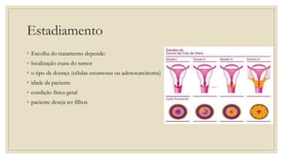 Estadiamento
◦ Escolha do tratamento depende:
◦ localização exata do tumor
◦ o tipo de doença (células escamosas ou adenocarcinoma)
◦ idade da paciente
◦ condição física geral
◦ paciente deseja ter filhos.
 