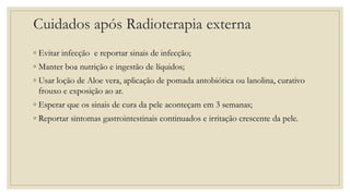 Cuidados após Radioterapia externa
◦ Evitar infecção e reportar sinais de infecção;
◦ Manter boa nutrição e ingestão de líquidos;
◦ Usar loção de Aloe vera, aplicação de pomada antobiótica ou lanolina, curativo
frouxo e exposição ao ar.
◦ Esperar que os sinais de cura da pele aconteçam em 3 semanas;
◦ Reportar sintomas gastrointestinais continuados e irritação crescente da pele.
 