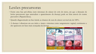 Lesões precursoras
◦ Existe uma fase pré-clínica (sem sintomas) do câncer do colo do útero, em que a detecção de
lesões precursoras (que antecedem o aparecimento da doença) pode ser feita através do exame
preventivo (Papanicolaou).
◦ Quando diagnosticado na fase inicial, as chances de cura do câncer cervical são de 100%.
◦ A doença é silenciosa em seu início e sinais e sintomas como sangramento vaginal, corrimento e
dor aparecem em fases mais avançadas da doença.
 