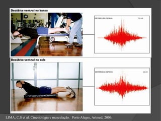 Considerações funcionais – extensão 
