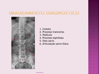 1. Costela
2. Processo transverso
3. Pedículo
4. Processo espinhoso
5. Osso sacro
6. Articulação sacro-ilíaca
smaj@usp.br
 