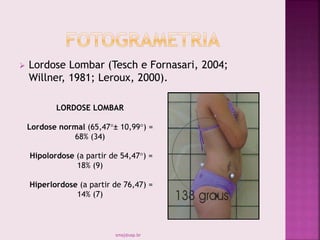  Lordose Lombar (Tesch e Fornasari, 2004;
Willner, 1981; Leroux, 2000).
smaj@usp.br
LORDOSE LOMBAR
Lordose normal (65,47°± 10,99°) =
68% (34)
Hipolordose (a partir de 54,47°) =
18% (9)
Hiperlordose (a partir de 76,47) =
14% (7)
 