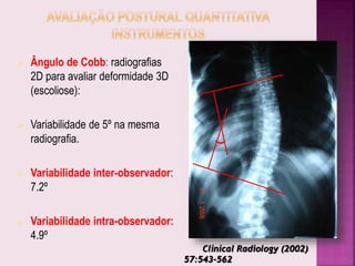  Ângulo de Cobb: radiografias
2D para avaliar deformidade 3D
(escoliose):
 Variabilidade de 5º na mesma
radiografia.
 Variabilidade inter-observador:
7.2º
 Variabilidade intra-observador:
4.9º
Clinical Radiology (2002)
57:543-562
 