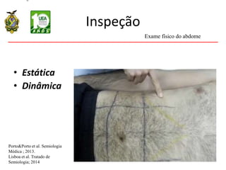 Inspeção
• Estática
• Dinâmica
Porto&Porto et al. Semiologia
Médica ; 2013.
Lisboa et al. Tratado de
Semiologia; 2014
Exame físico do abdome
 