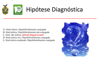 Hipótese Diagnóstica
A- Sind ictérica. Hiperbilirrubinemia conjugada
B- Sind ictérica. Hiperbilirrubinemia não conjugada
C- Sind não ictérica. frênulo lingual normal
D- Sind ictérica leve. Hiperbilirrubinemia conjugada
E- Sind ictérica moderada. Hiperbilirrubinemia conjugada
 