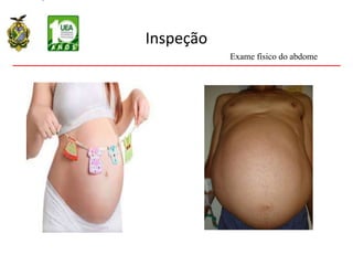 Inspeção
Exame físico do abdome
 