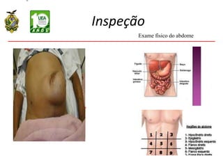 Inspeção
Exame físico do abdome
 