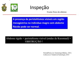 Inspeção
A presença de peristaltismos visíveis em região
mesogástrica no indivíduo magro com abdome
flácido pode ser normal.
Abdome rígido + peristaltismo visível (ondas de Kussmaul) =
OBSTRUÇÃO !
Exame físico do abdome
Porto&Porto et al. Semiologia Médica ; 2013.
Lisboa et al. Tratado de Semiologia; 2014
 