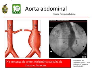 Aorta abdominal
Na presença de sopro, obrigatória ausculta de
ilíacas e femorais.
Exame físico do abdome
Porto&Porto et al.
Semiologia Médica ; 2013.
Lisboa et al. Tratado de
Semiologia; 2014
 