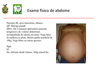 Exame físico de abdome
Paciente JK, sexo masculino, 44anos.
QP- Barriga grande
HDA- Há 3 semanas apresentou aumento
progressivo do volume abdominal,
acompanhado de edema em mmii. Nega fator
de melhora ou piora. Refere ganho ponderal de
10kg. Nega febre ou outras queixas.
Hpp-
hf-
Hs- etilismo desde 16anos. 560g etanol/dia
 