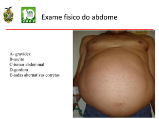 Exame fisico do abdome
A- gravidez
B-ascite
C-tumor abdominal
D-gordura
E-todas alternativas corretas
 