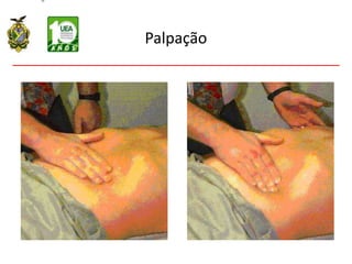 Palpação
 