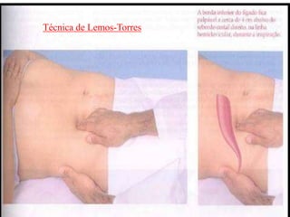 Técnica de Lemos-Torres
 