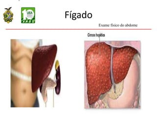 Fígado
Exame físico do abdome
 