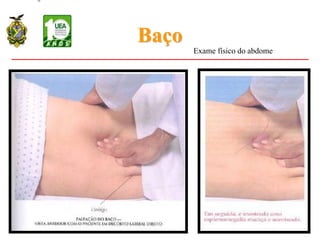 Baço
Exame físico do abdome
 