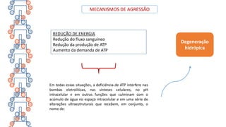 MECANISMOS DE AGRESSÃO
REDUÇÃO DE ENERGIA
Redução do fluxo sanguíneo
Redução da produção de ATP
Aumento da demanda de ATP
Em todas essas situações, a deficiência de ATP interfere nas
bombas eletrolíticas, nas sínteses celulares, no pH
intracelular e em outras funções que culminam com o
acúmulo de água no espaço intracelular e em uma série de
alterações ultraestruturais que recebem, em conjunto, o
nome de:
Degeneração
hidrópica
 