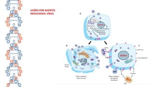 LESÕES POR AGENTES
INFECCIOSOS: VÍRUS
 