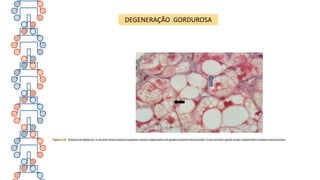 DEGENERAÇÃO GORDUROSA
 