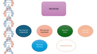 NECROSE
Necrose por
coagulação
Necrose por
liquefação
Necrose
lítica
Necrose
caseosa
Necrose
Gomosa
Esteatonecrose
 