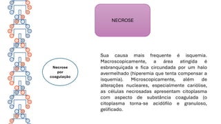 NECROSE
Necrose
por
coagulação
Sua causa mais frequente é isquemia.
Macroscopicamente, a área atingida é
esbranquiçada e fica circundada por um halo
avermelhado (hiperemia que tenta compensar a
isquemia). Microscopicamente, além de
alterações nucleares, especialmente cariólise,
as células necrosadas apresentam citoplasma
com aspecto de substância coagulada (o
citoplasma torna-se acidófilo e granuloso,
gelificado.
 